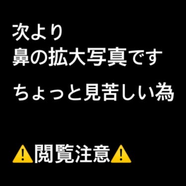 ノーモアブラックヘッド(ノーズピーリング)/One-day's you/スクラブ・ゴマージュを使ったクチコミ（3枚目）