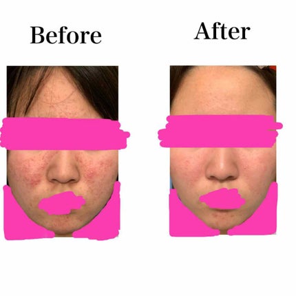 モイスト ローション/リッツ/化粧水を使ったクチコミ(1枚目)