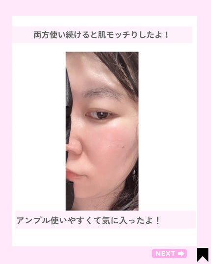 ビタミンCショット(VCショット)美容液/AMPLE:N/美容液を使ったクチコミ(7枚目)