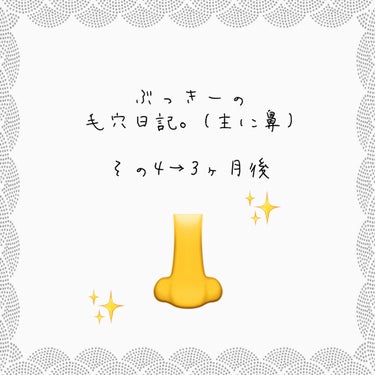 #ぶっきーと毛穴ケア　第4段記録です〜
山場の3ヶ月を一旦超えてどう変化したか、見ていきたいと思います！

⚠️画像2枚目以降は毛穴写真あります。閲覧ご注意ください。


ーーーーーーーーーーーーーーー