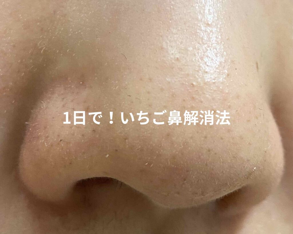 カスターオイル（ひまし油）/生活の木/ボディオイルを使ったクチコミ（1枚目）