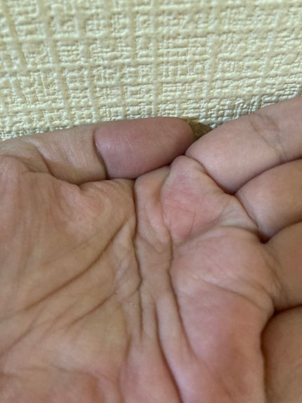 ダーマLウルセラPHA/クオリティファースト/美容液を使ったクチコミ(6枚目)