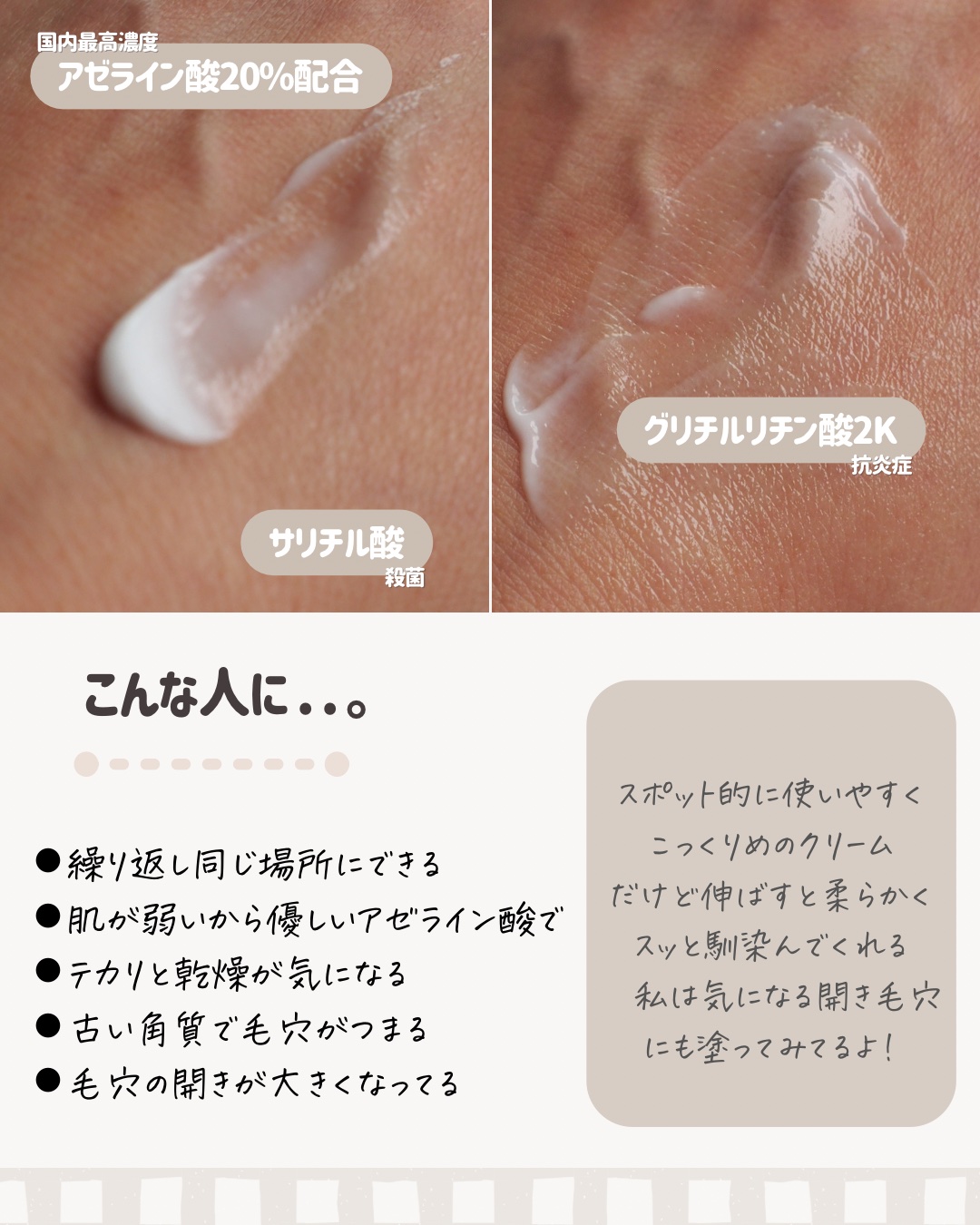 AZ アゼフィットスポッツ/NIKI PITA/フェイスクリームを使ったクチコミ（3枚目）