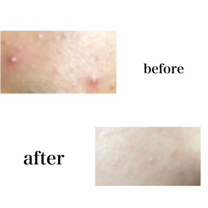 薬用スキンクリーム/オードムーゲ/フェイスクリームを使ったクチコミ(2枚目)