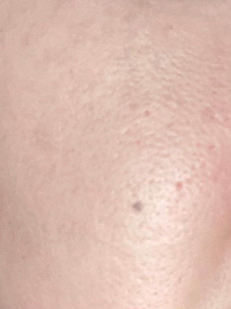 カバーアッププロコンシーラー/TFIT/パレットコンシーラーを使ったクチコミ(6枚目)