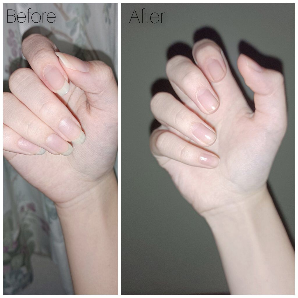 エテュセ クイックケアコート/ettusais/ネイルオイル・トリートメントを使ったクチコミ（1枚目）