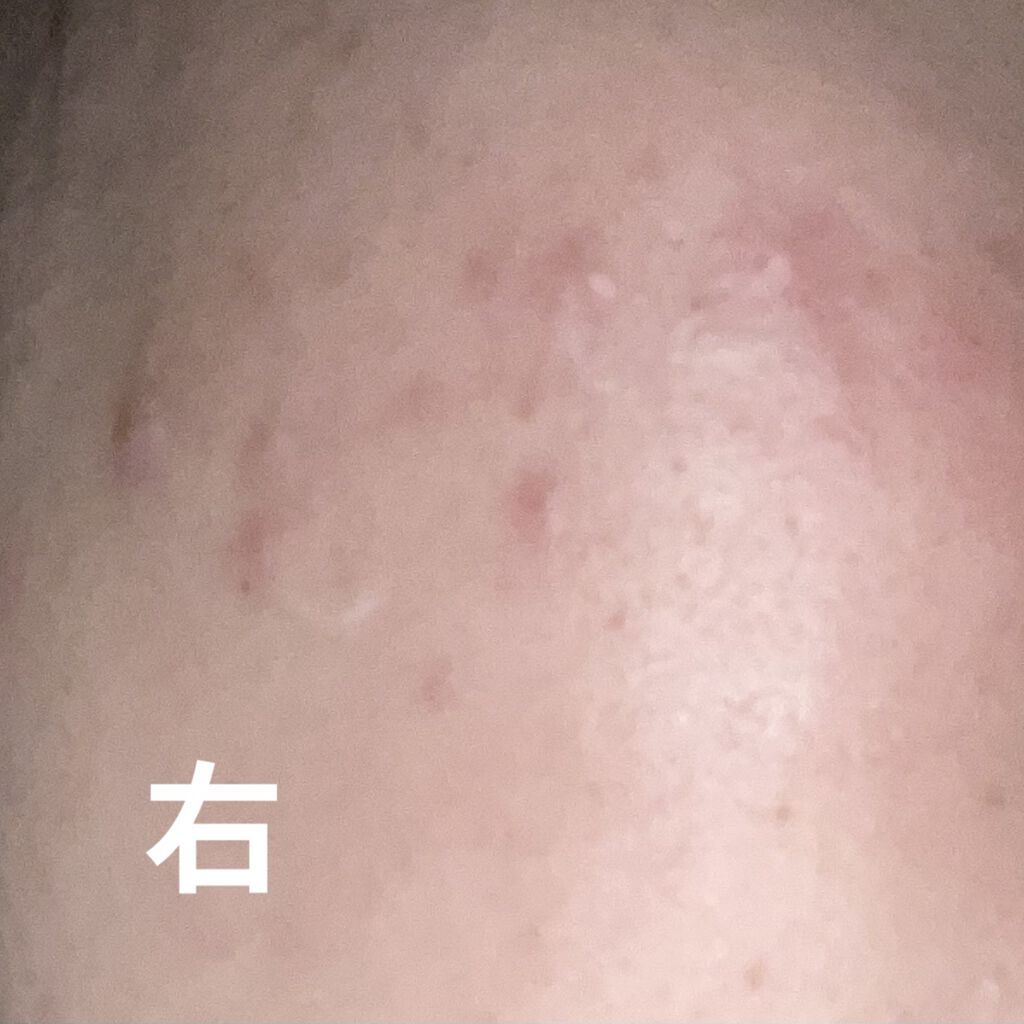 潤浸保湿 フェイスクリーム/キュレル/フェイスクリームを使ったクチコミ（2枚目）