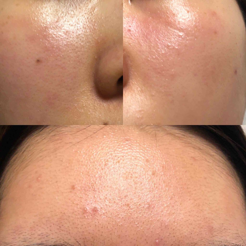 ナ梨 on LIPS 「2020.03.15朝撮ったものと夜撮ったもので照明が違って見..」(2枚目)