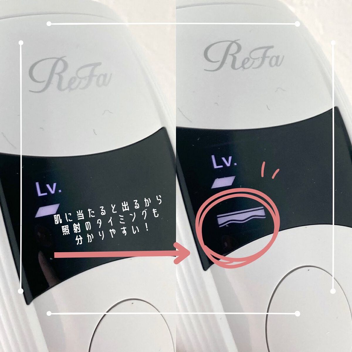 リファ ビューテックエピ/ReFa/家庭用脱毛器を使ったクチコミ(5枚目)