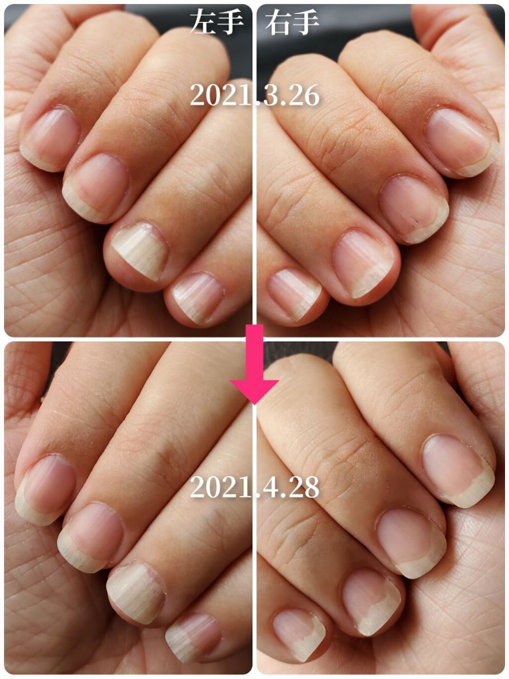 クリスタルネイルシャイナー/トープラン(TO-PLAN)/ネイル用品を使ったクチコミ（3枚目）