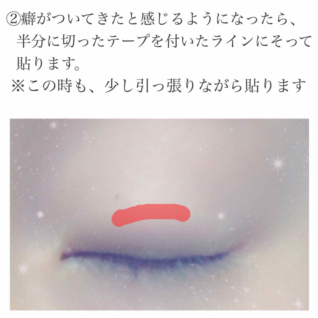 のびーるアイテープ（絆創膏タイプ、レギュラー）/DAISO/二重まぶた用アイテムを使ったクチコミ（3枚目）