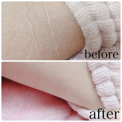 むくみぱっくん/スベルティ/健康サプリメントを使ったクチコミ(5枚目)