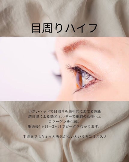 mi_ta2359フォロバ on LIPS 「🧚♀️おすすめ美容医療5選/🧚♀️𓂃目の下のお悩み編𓂃30..」(5枚目)