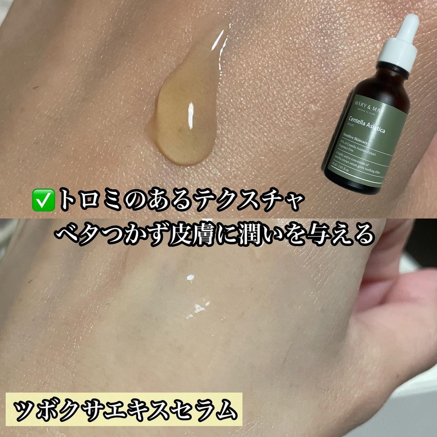 センテラ アシアティカ セラム/MARY&MAY/美容液を使ったクチコミ(4枚目)