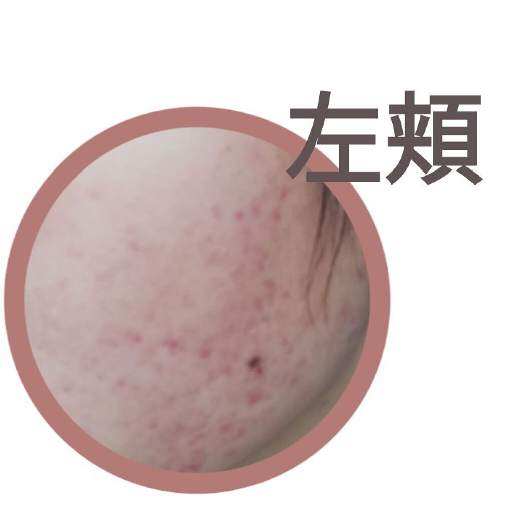 DHC マルチビタミン/DHC/美容サプリメントを使ったクチコミ(3枚目)