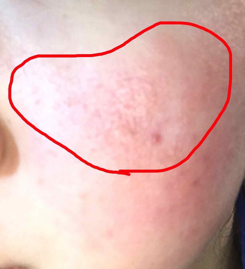 明色美顔水 薬用化粧水/美顔/化粧水を使ったクチコミ（2枚目）