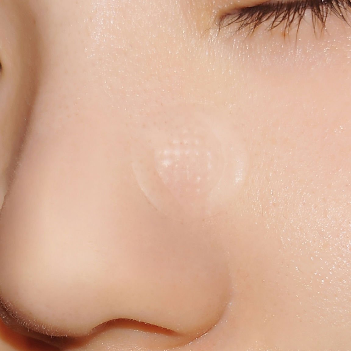 ACケア/ACROPASS/その他スキンケアを使ったクチコミ（3枚目）