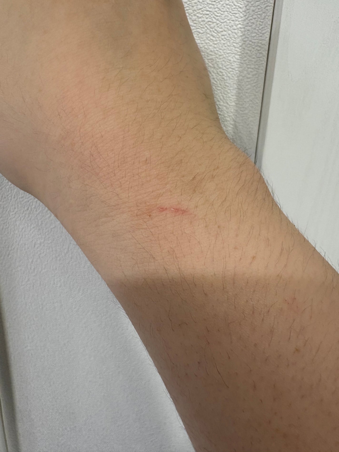 アイレノール クマクリーム/IRENOL/アイケア・アイクリームを使ったクチコミ(3枚目)