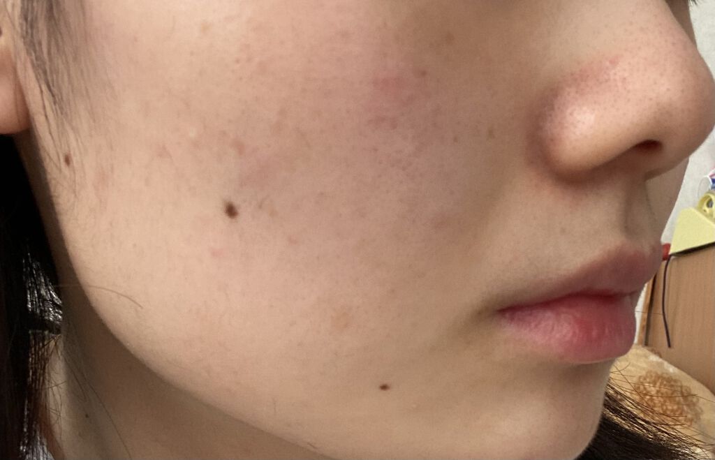 エマルジョンリムーバー　300ml/200ml/水橋保寿堂製薬/その他洗顔料を使ったクチコミ（1枚目）