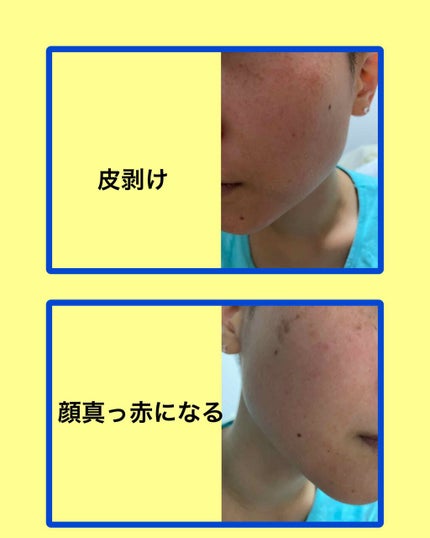 ミラミックス/ZO Skin Health/フェイスクリームを使ったクチコミ(2枚目)