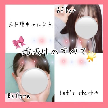 SENKA（専科） パーフェクトホイップ アクネケアのクチコミ「【保存版】

垢抜けのすべて🎀☁️

垢抜けについて思いつく限り書きましたー！

.....」（1枚目）