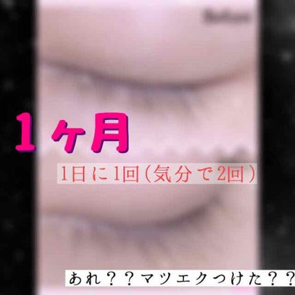 スカルプD ボーテ ピュアフリーアイラッシュセラム プレミアム/アンファー(スカルプD)/まつげ美容液を使ったクチコミ(1枚目)