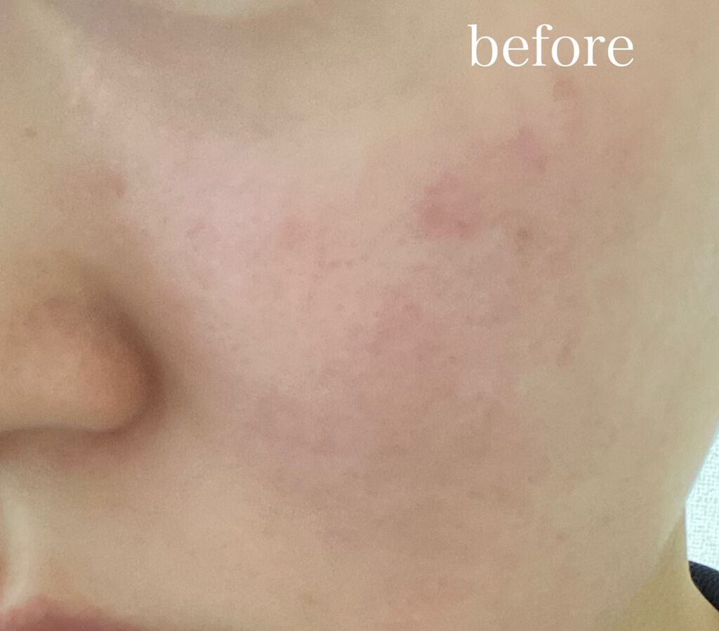 ミネラルクリーミーファンデーション/MiMC/クリーム・エマルジョンファンデーションを使ったクチコミ(2枚目)