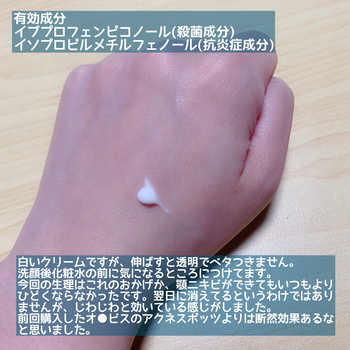 メディカルクリームc(医薬品)/メンソレータム アクネス25/その他を使ったクチコミ（2枚目）