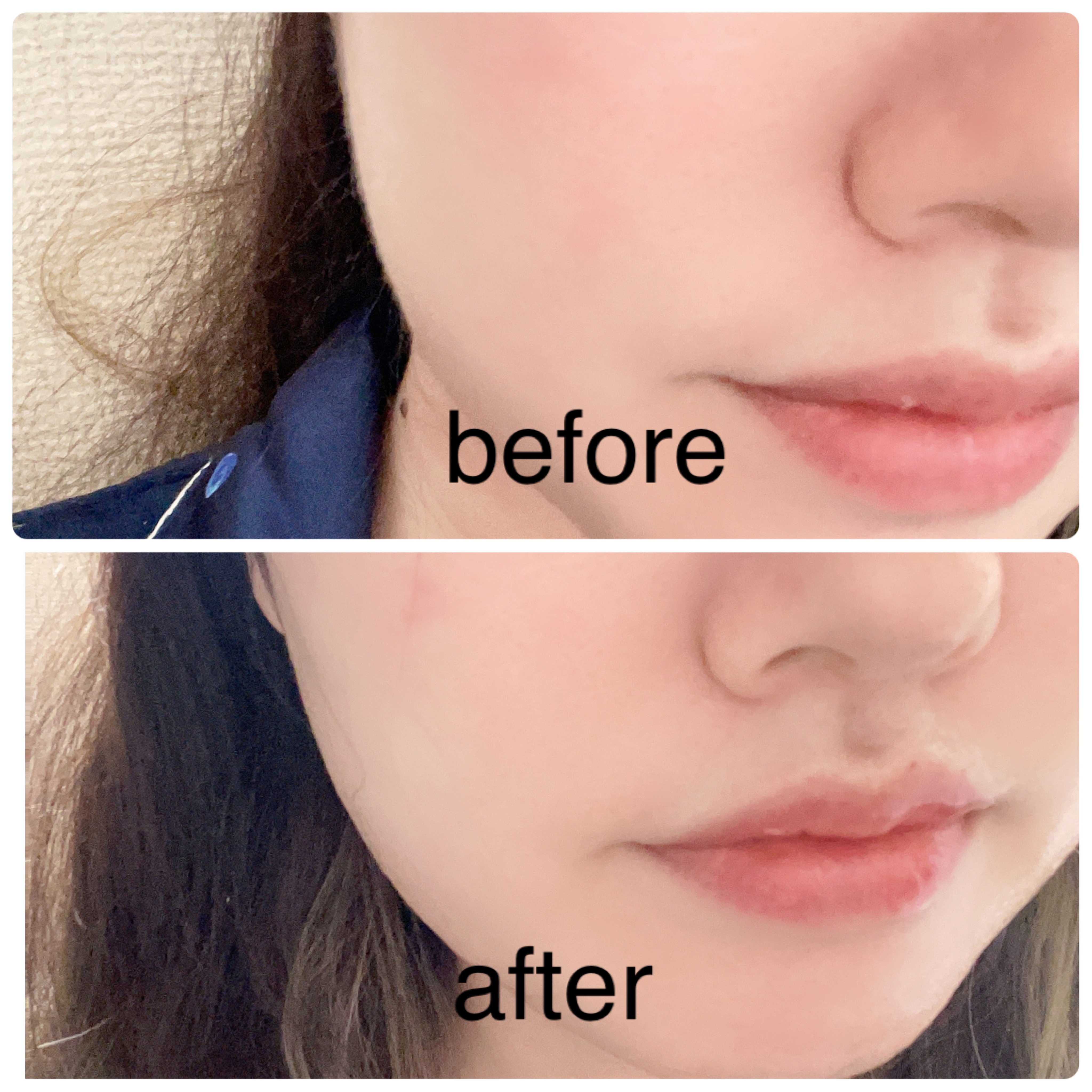 ティーツリーオイルパック/NOWATER/シートマスク・パックを使ったクチコミ（2枚目）