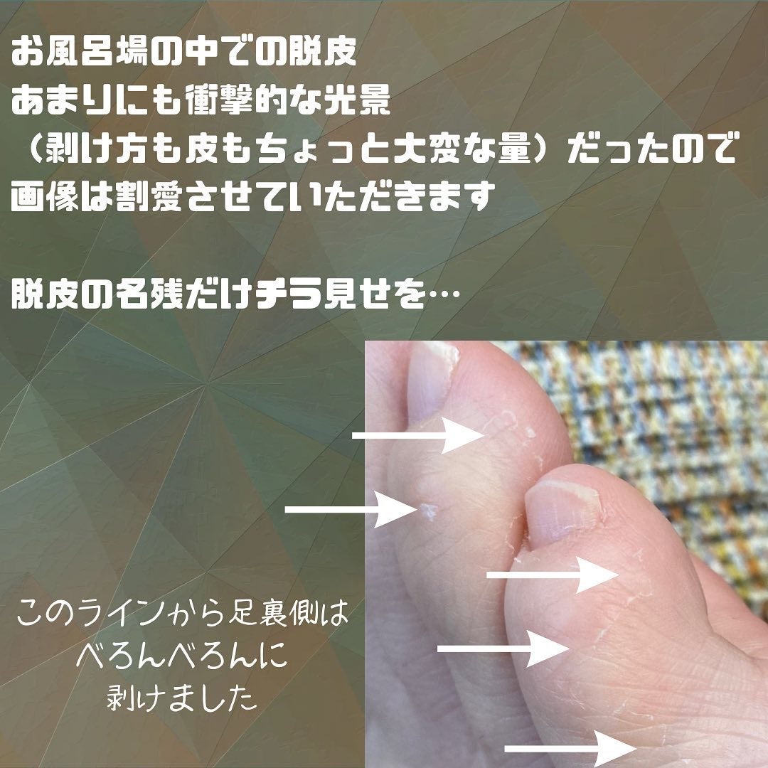 ベビーフット イージーパック 60分 Mサイズ パッションフルーツの香り/LIBERTA (リヴェルタ)/レッグ・フットケアを使ったクチコミ(7枚目)