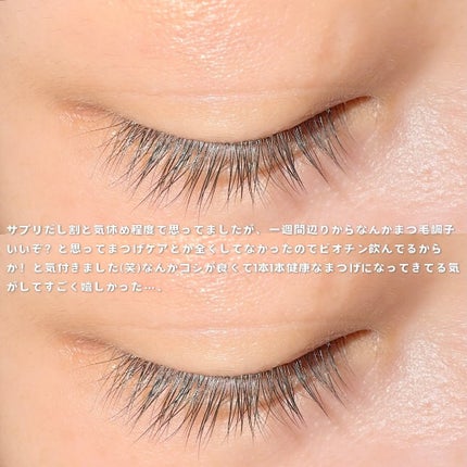 BIOTIN/メディタミン/美容サプリメントを使ったクチコミ(4枚目)