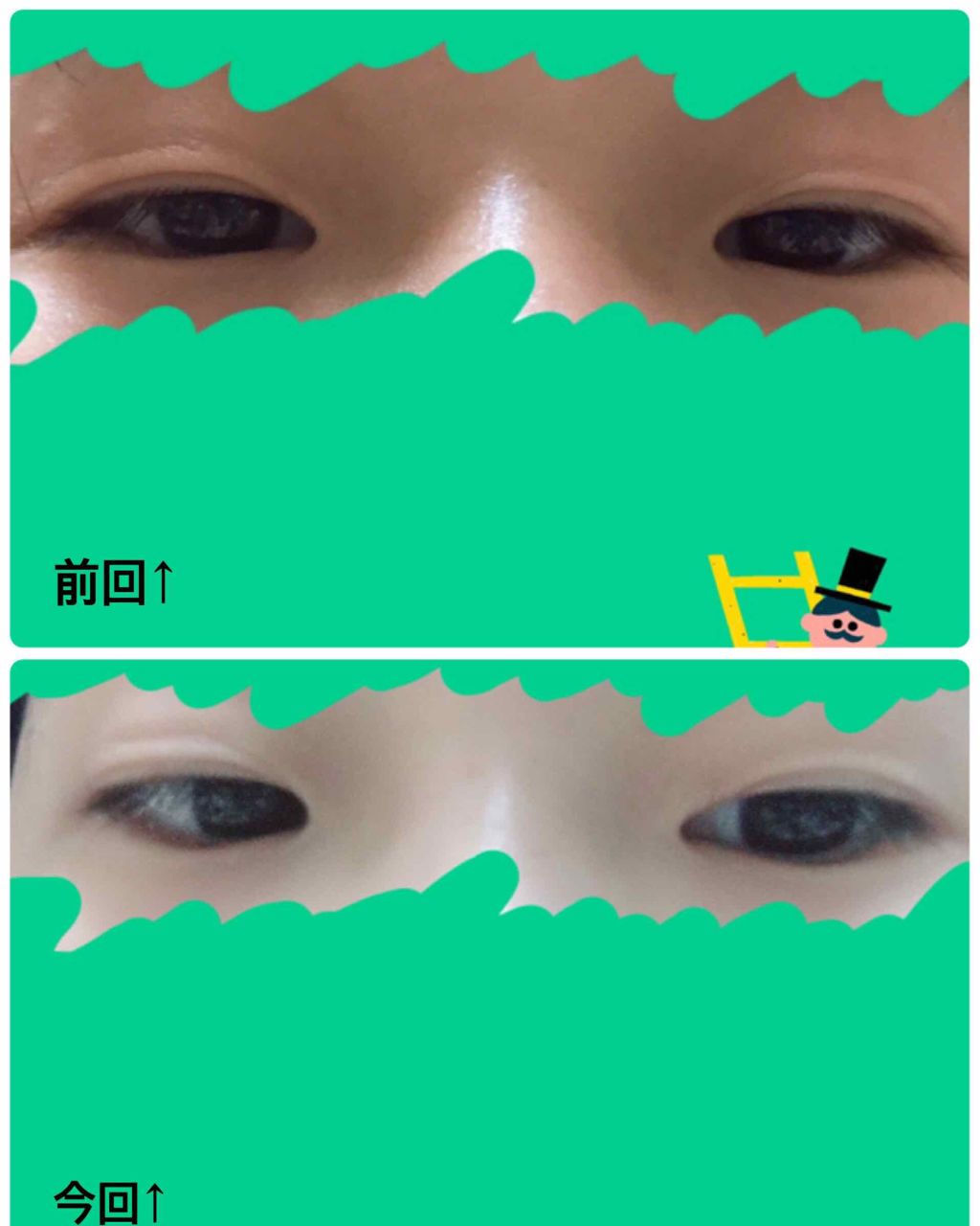 さきいか。 on LIPS 「こんにちは。しばらく姿を消していたさきいか。です今回も二重報告..」(2枚目)