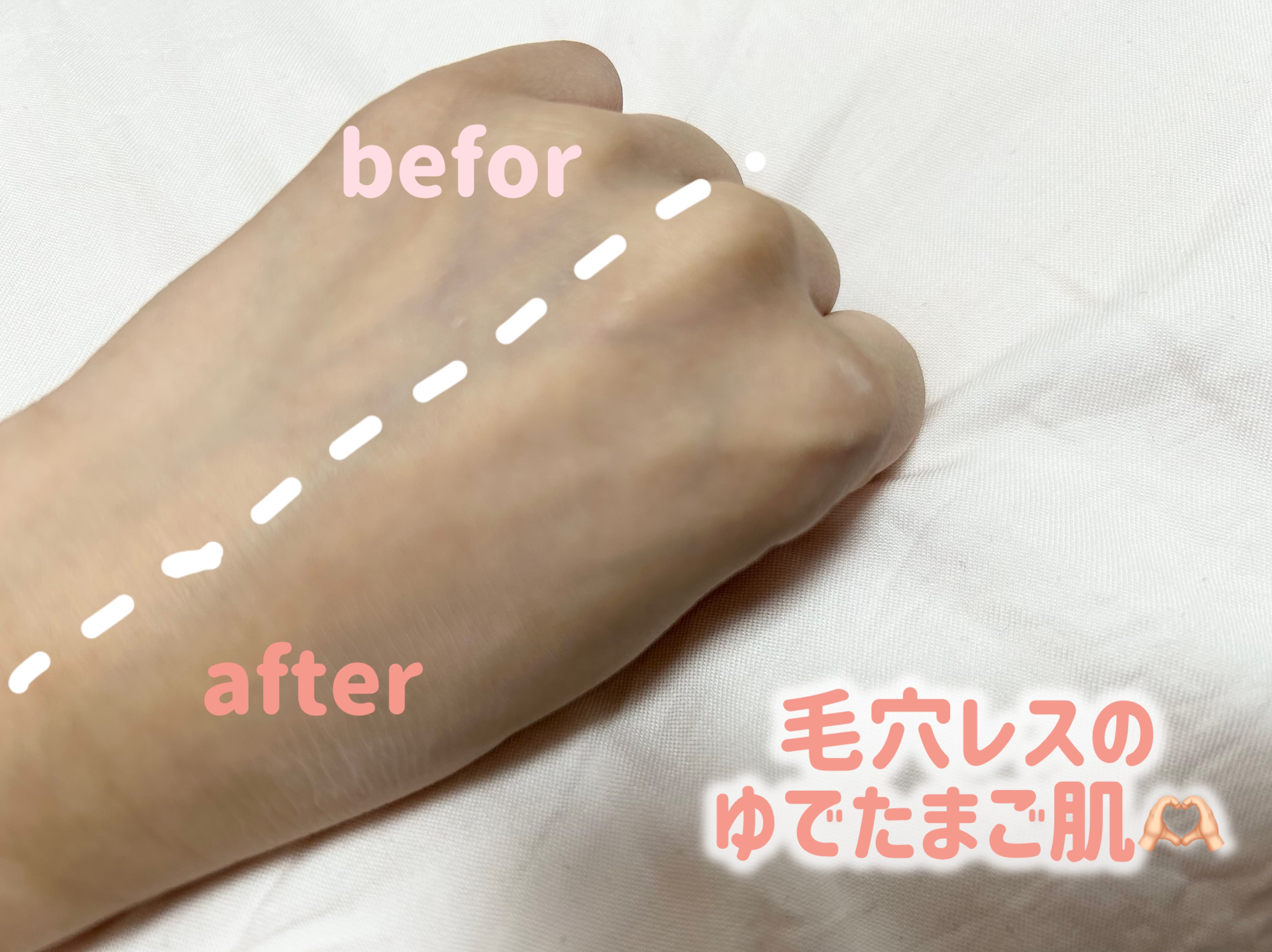 を使ったクチコミ（2枚目）