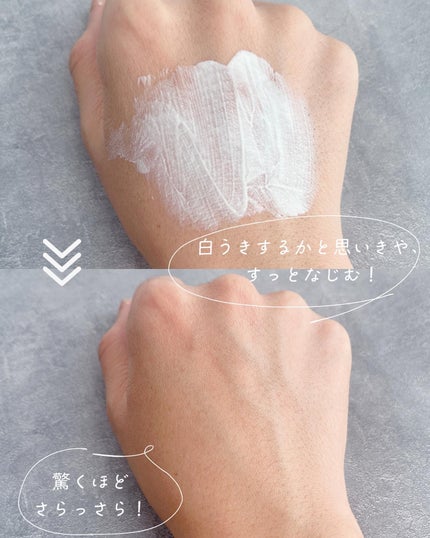 エーキュアショットスポットパッチ/obsero/にきびパッチを使ったクチコミ(4枚目)