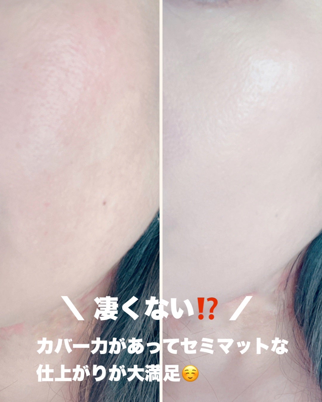 ピンクティーツリーカバープライマークッション/APLIN/クッションファンデーションを使ったクチコミ(5枚目)