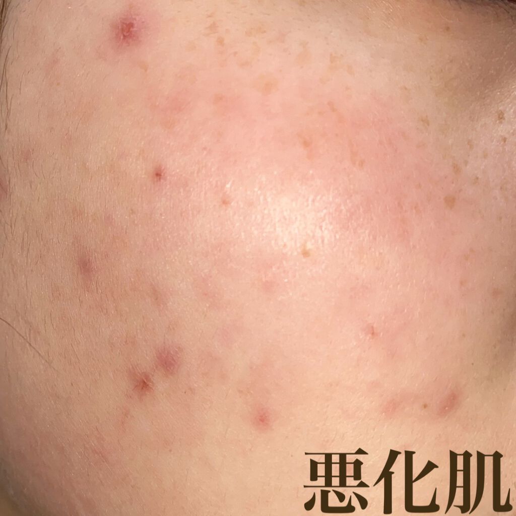 マデカソ CICAシートマスク/A’pieu/シートマスク・パックを使ったクチコミ(3枚目)