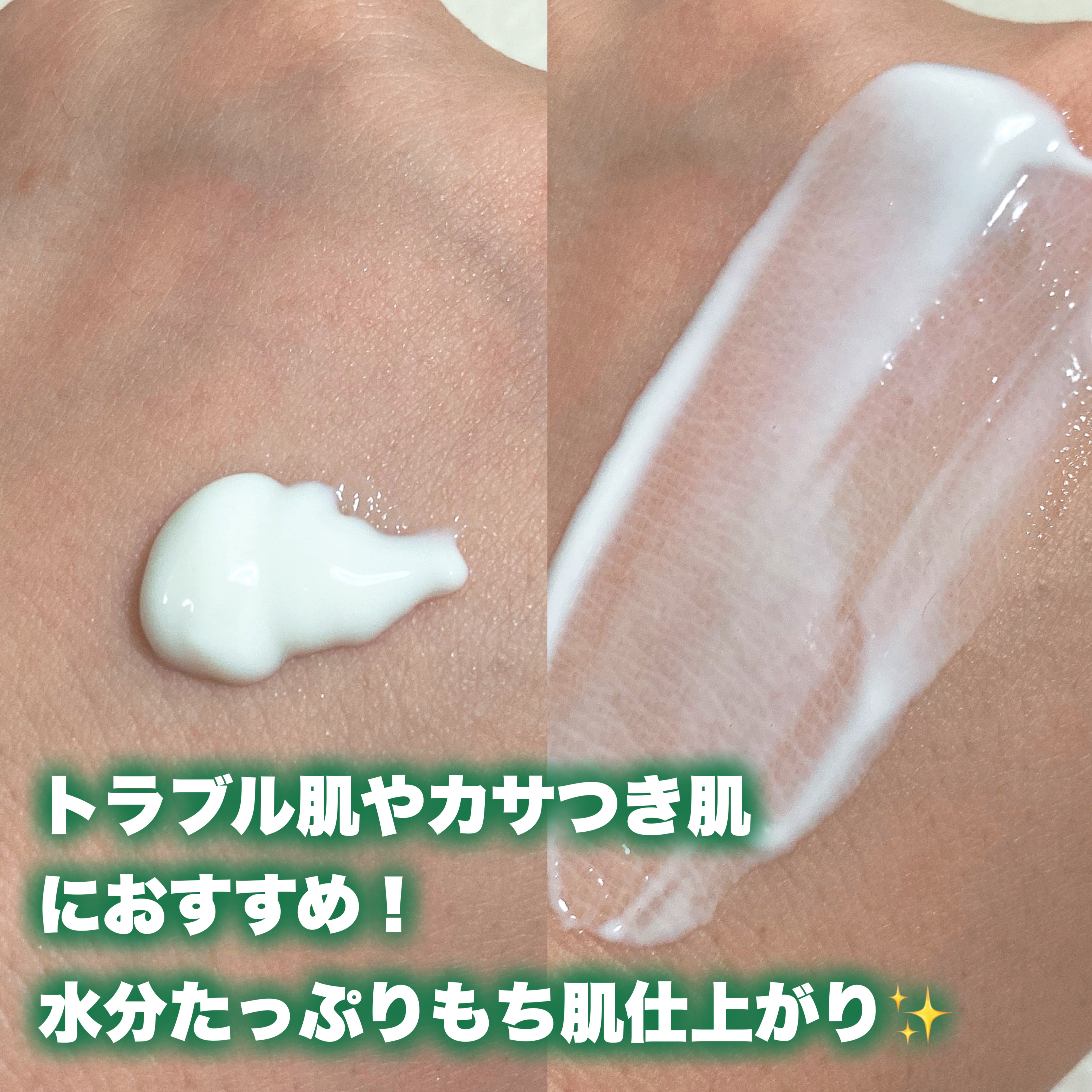 ブライトニングピーリングジェル/Dr.G/ピーリングを使ったクチコミ（3枚目）