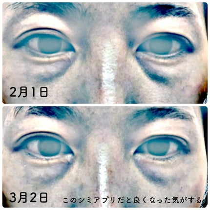 Cemenrete Calcium Intense Cream/Dr.Melaxin/フェイスクリームを使ったクチコミ(5枚目)