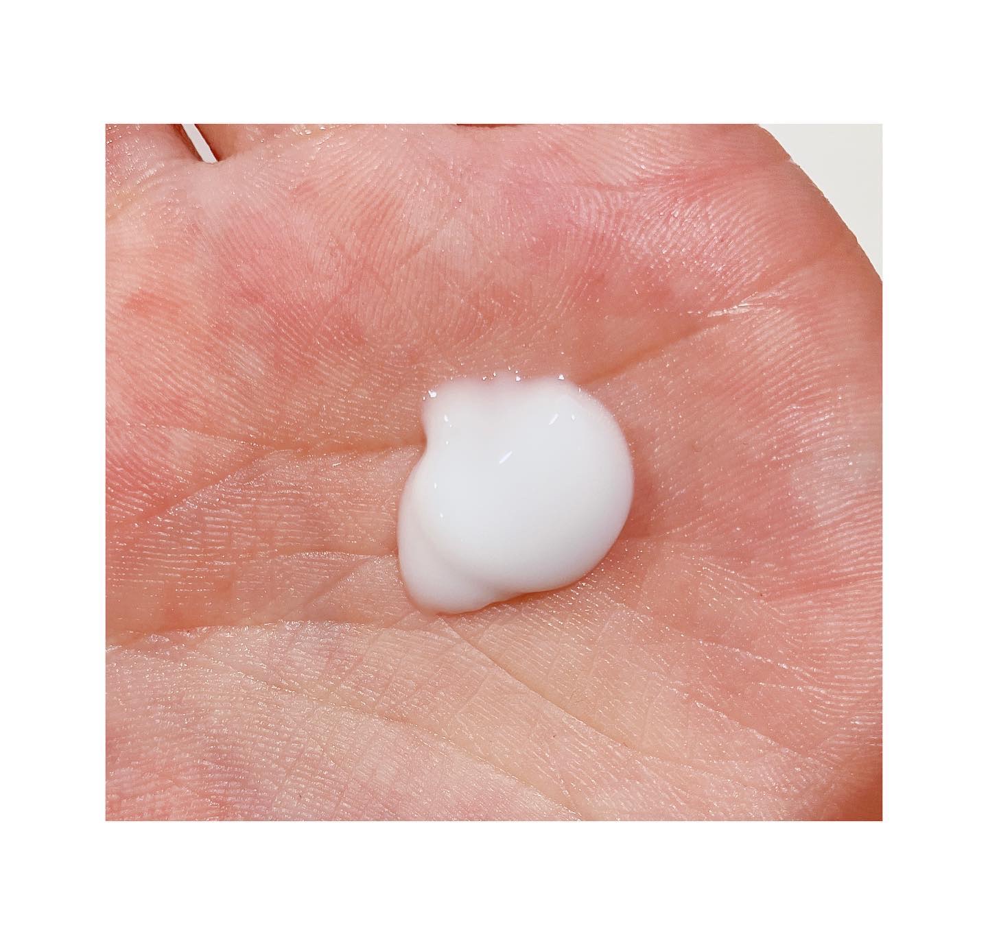 ミノン アミノモイスト 薬用アクネケア ローション/ミノン/化粧水を使ったクチコミ（3枚目）