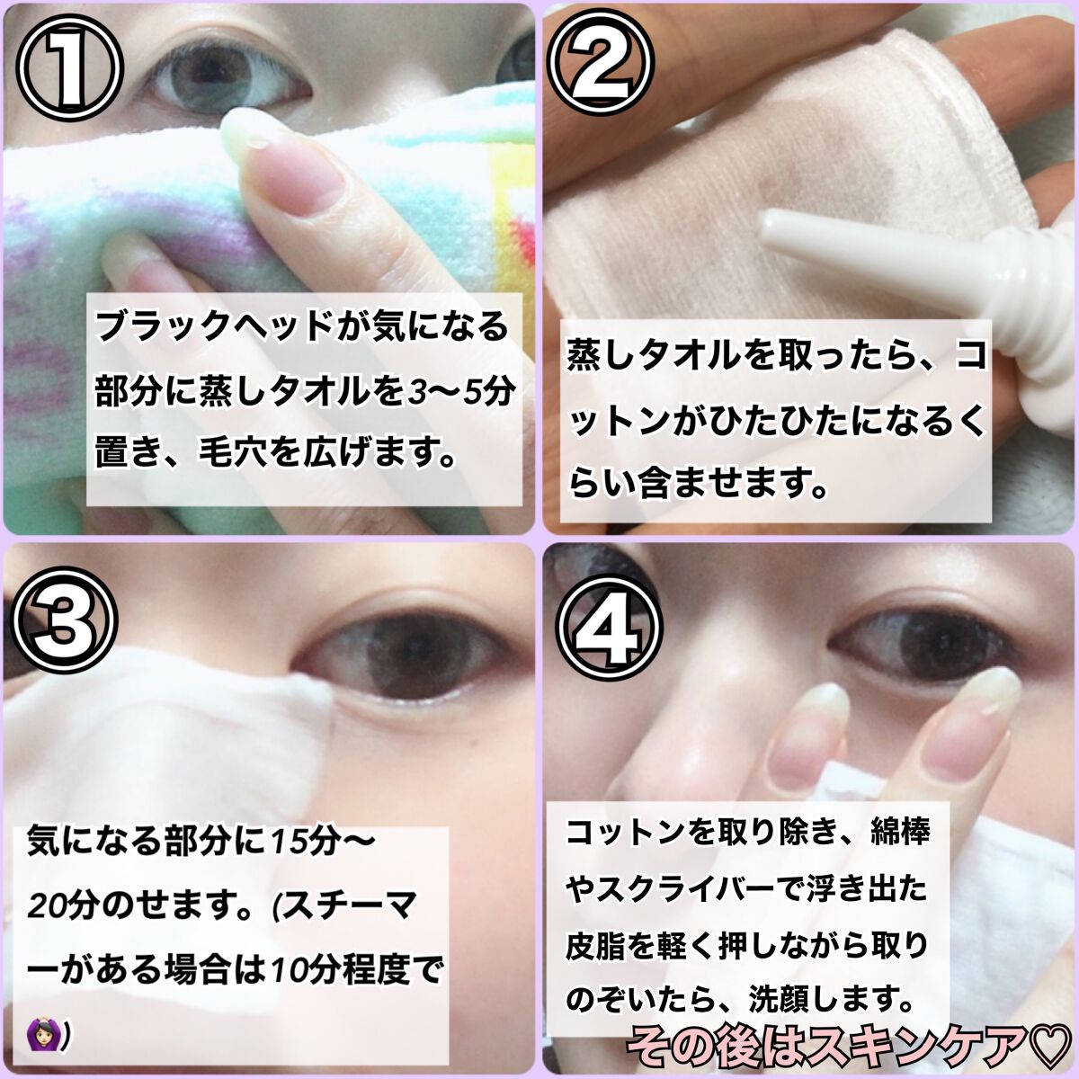 アクレオンセボエクストラクター/ANACIS/その他スキンケアを使ったクチコミ(3枚目)