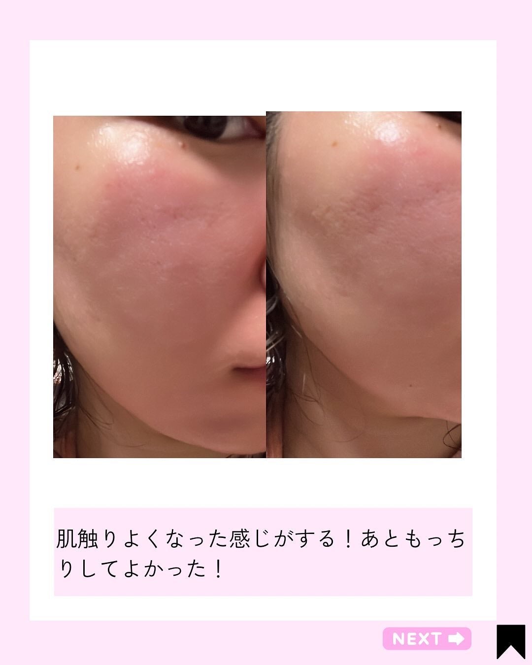 Kana on LIPS 「美肌へのアプローチ♡/@kana.cosme2525他の投稿は..」(6枚目)