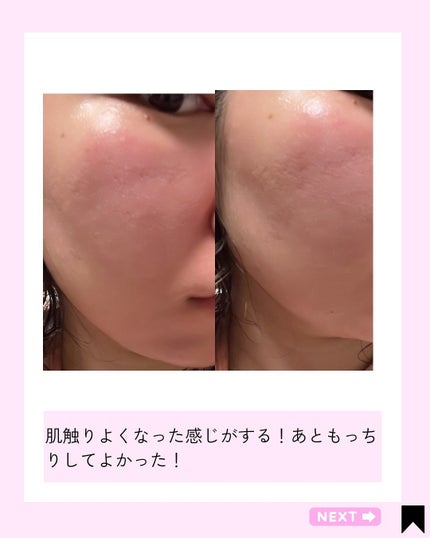 Kana on LIPS 「美肌へのアプローチ♡/@kana.cosme2525他の投稿は..」(6枚目)