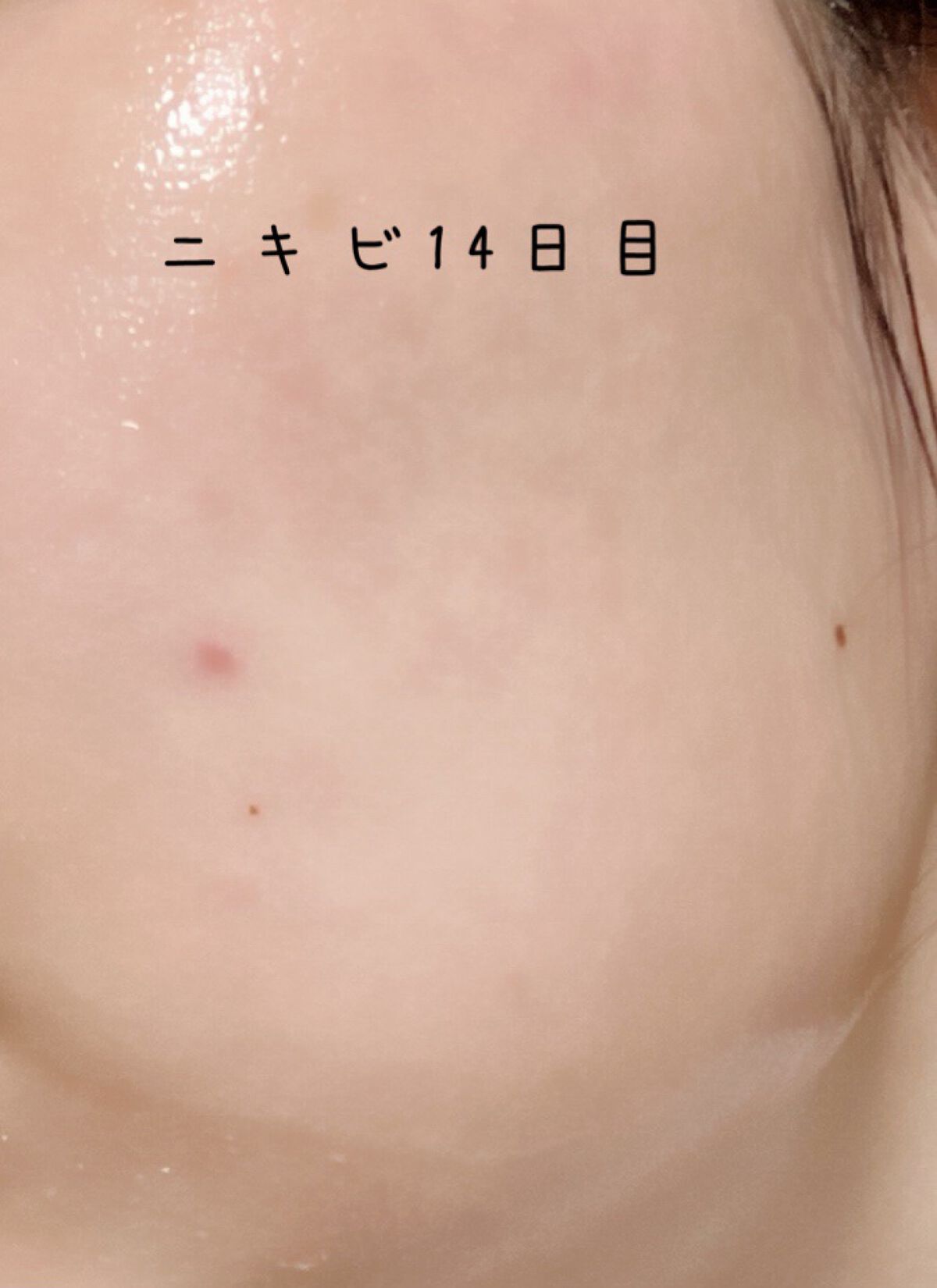 ブライトニングケア ローション RM（医薬部外品）/アクアレーベル/化粧水を使ったクチコミ（1枚目）