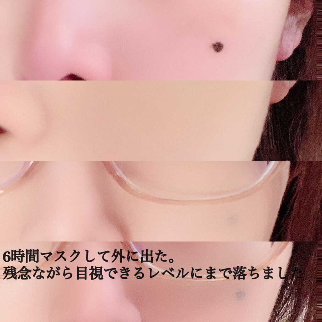 スポッツカバー ファウンデイション/SHISEIDO/クリームコンシーラーを使ったクチコミ(5枚目)