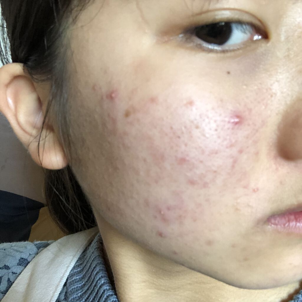 ディープモイスチャースプレー/キュレル/ミスト状化粧水を使ったクチコミ（2枚目）