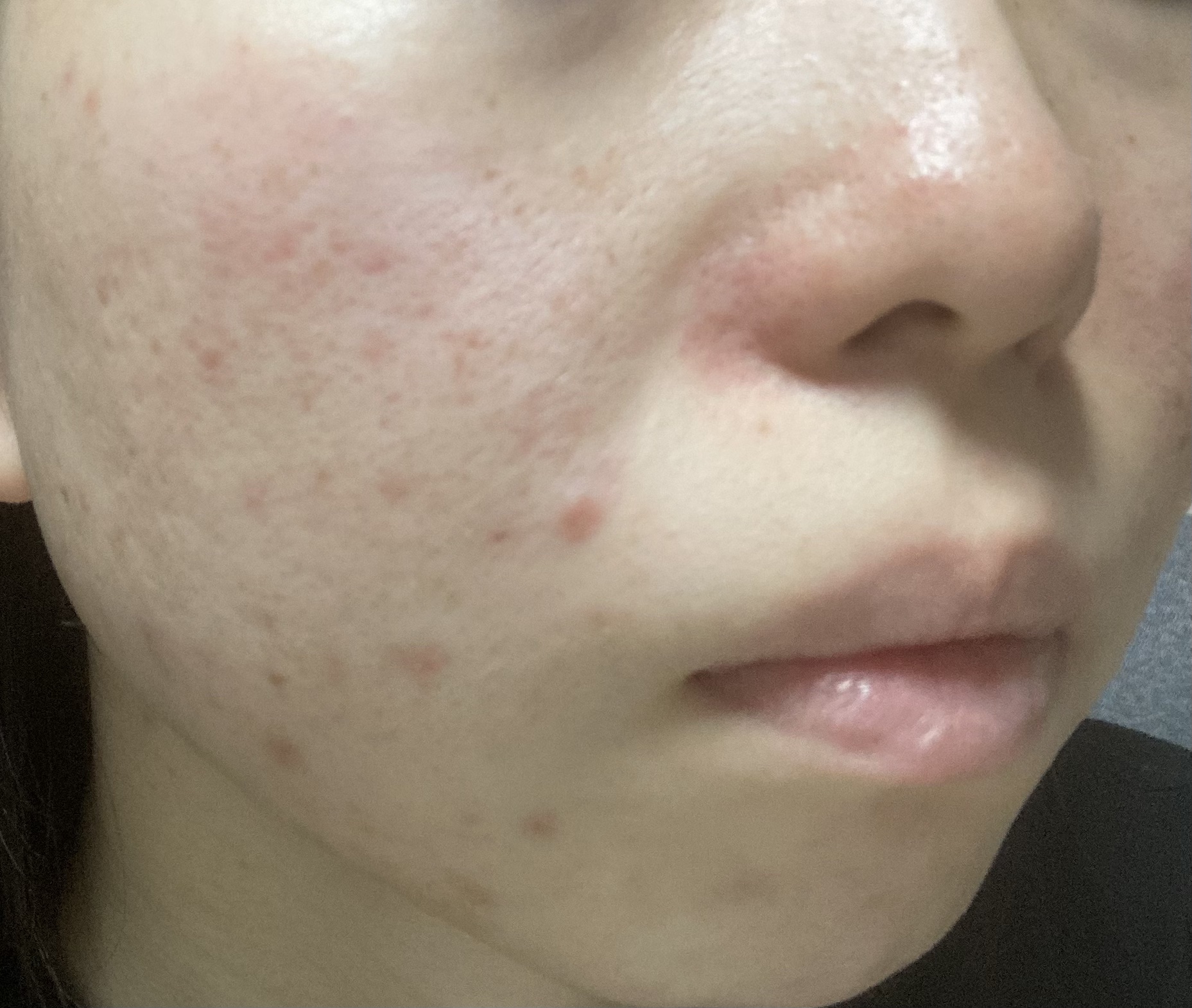 薬用ホワイトニングローションα EX/TOUT VERT/化粧水を使ったクチコミ（2枚目）