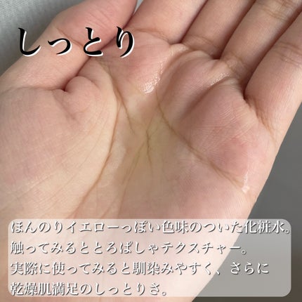 エンリッチ ローション/サイクルプラス/化粧水を使ったクチコミ(6枚目)