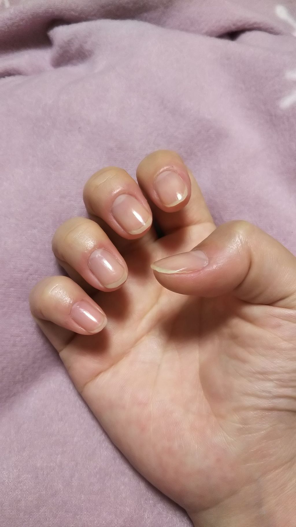 ディーアップファンデーション/D-UP/ネイルベースコートを使ったクチコミ(3枚目)