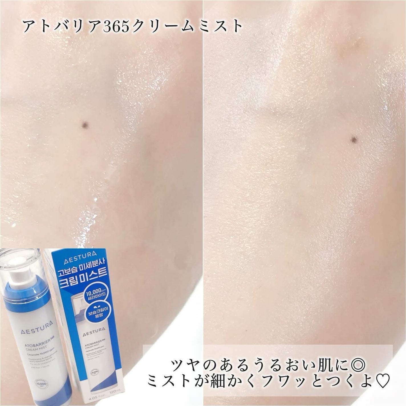 アトバリア365クリーム/AESTURA/フェイスクリームを使ったクチコミ(4枚目)