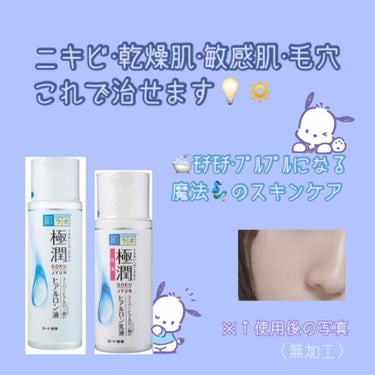 極潤 ヒアルロン乳液(旧)/肌ラボ/乳液を使ったクチコミ（1枚目）